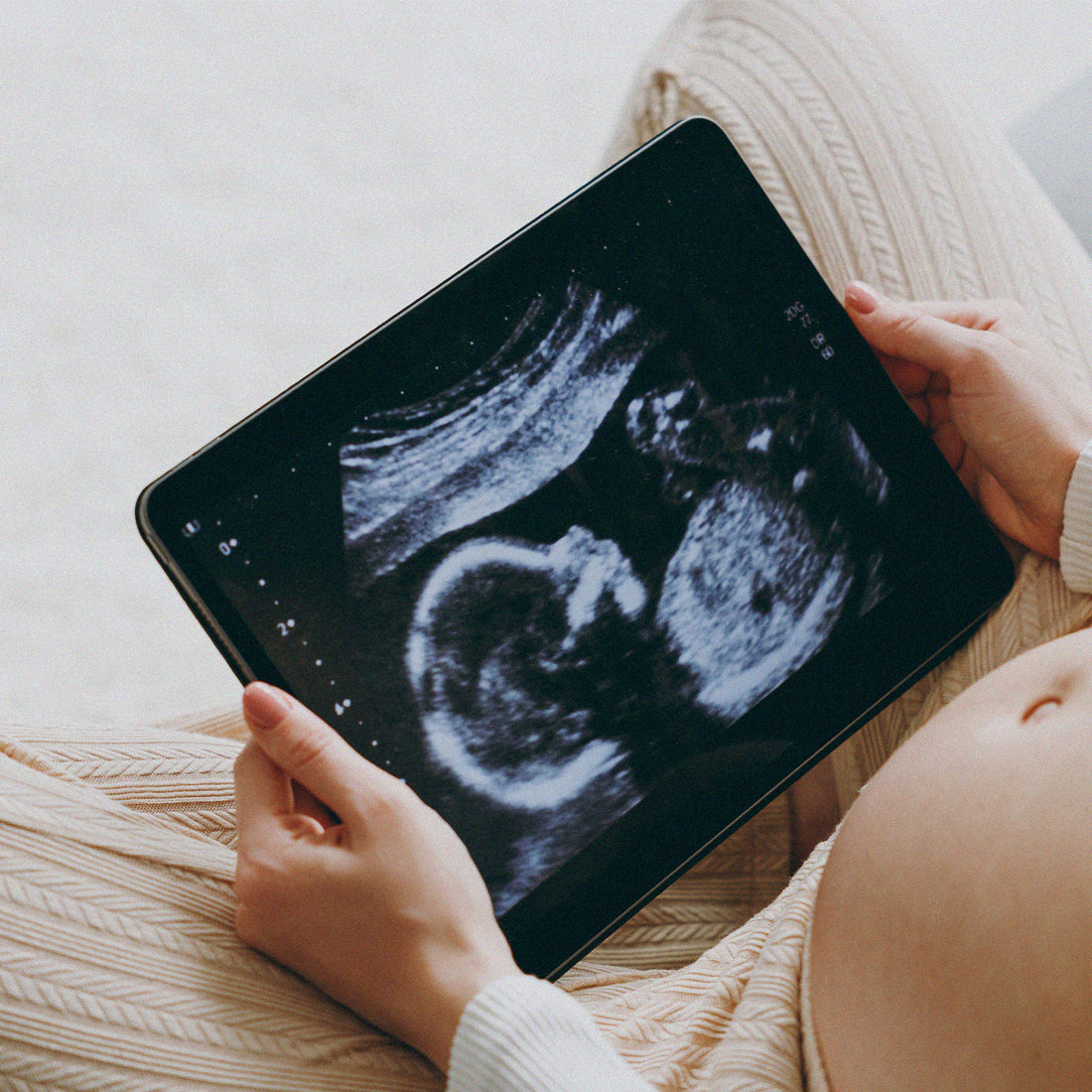 Femme enceinte regarde une échographie